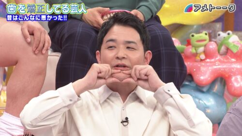 歯を矯正してる芸人